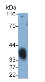 CD7 Antibody in Western Blot (WB)