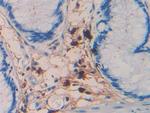Tryptase Antibody in Immunohistochemistry (Paraffin) (IHC (P))