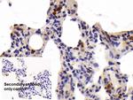 Tryptase Antibody in Immunohistochemistry (Paraffin) (IHC (P))