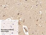 ACVR2A Antibody in Immunohistochemistry (Paraffin) (IHC (P))