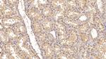 ACVR2A Antibody in Immunohistochemistry (Paraffin) (IHC (P))