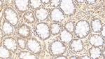 IL-17A Antibody in Immunohistochemistry (Paraffin) (IHC (P))