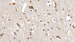 FAP Antibody in Immunohistochemistry (Paraffin) (IHC (P))