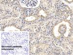 FAP Antibody in Immunohistochemistry (Paraffin) (IHC (P))