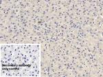 FAP Antibody in Immunohistochemistry (Paraffin) (IHC (P))