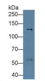 Procollagen I N-Peptide Monoclonal Antibody (C8)
