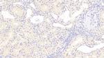 RHD Antibody in Immunohistochemistry (Paraffin) (IHC (P))