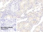 RHD Monoclonal Antibody (C1)
