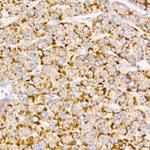MMP3 Antibody in Immunohistochemistry (Paraffin) (IHC (P))