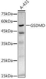 GSDMD Recombinant Rabbit Monoclonal Antibody (5U7R7)