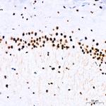 PARP1 Antibody in Immunohistochemistry (Paraffin) (IHC (P))