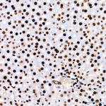 PARP1 Antibody in Immunohistochemistry (Paraffin) (IHC (P))