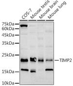 TIMP2 Recombinant Rabbit Monoclonal Antibody (5P3T3)