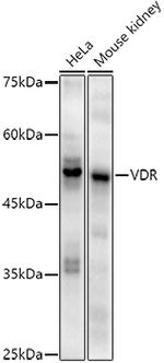 VDR Recombinant Rabbit Monoclonal Antibody (2R1F6)