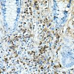 IL-17A Recombinant Rabbit Monoclonal Antibody (4V7Y6)