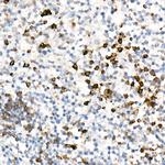 IL-17A Antibody in Immunohistochemistry (Paraffin) (IHC (P))