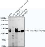 TGFBI Recombinant Rabbit Monoclonal Antibody (10C8Y4)