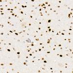 FTO Antibody in Immunohistochemistry (Paraffin) (IHC (P))