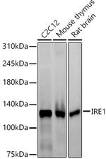 IRE1 alpha Recombinant Rabbit Monoclonal Antibody (8P0L0)