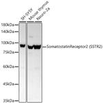 SSTR2 Recombinant Rabbit Monoclonal Antibody (2Q1Z2)