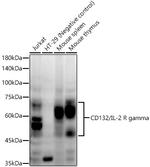 IL2RG Recombinant Rabbit Monoclonal Antibody (10B9X6)