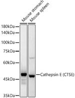 Cathepsin E Recombinant Rabbit Monoclonal Antibody (4N7F7)