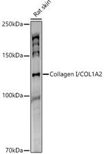 COL1A2 Recombinant Rabbit Monoclonal Antibody (9Q1C6)