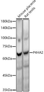 P4HA2 Recombinant Rabbit Monoclonal Antibody (6A6Z2)