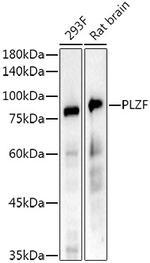 PLZF Recombinant Rabbit Monoclonal Antibody (8F9X2)
