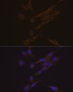 CHI3L1 Recombinant Rabbit Monoclonal Antibody (7T1R3)