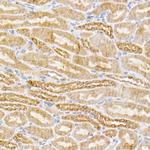 SIRT3 Recombinant Rabbit Monoclonal Antibody (7O4G7)