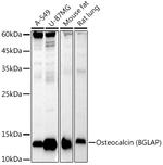 Osteocalcin Recombinant Rabbit Monoclonal Antibody (2T1J7)