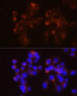 LDLR Recombinant Rabbit Monoclonal Antibody (10K4L8)