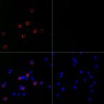 SARS-CoV-2 Spike Protein S1 Recombinant Rabbit Monoclonal Antibody (3E7H5)