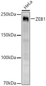 ZEB1 Recombinant Rabbit Monoclonal Antibody (8V5U0)