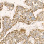 PGAM5 Antibody in Immunohistochemistry (Paraffin) (IHC (P))