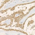 PGAM5 Antibody in Immunohistochemistry (Paraffin) (IHC (P))