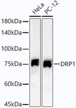 DNM1L Recombinant Rabbit Monoclonal Antibody (10P2X1)