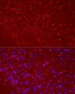 DKK3 Recombinant Rabbit Monoclonal Antibody (7O2I10)