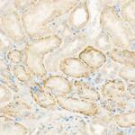AMID Recombinant Rabbit Monoclonal Antibody (7X9B2)