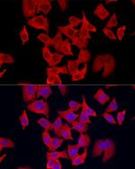 S100A11 Recombinant Rabbit Monoclonal Antibody (8U1Y8)