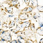 S100A11 Antibody in Immunohistochemistry (Paraffin) (IHC (P))