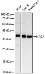 NACA Recombinant Rabbit Monoclonal Antibody (9S6U3)