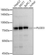 PLOD3 Recombinant Rabbit Monoclonal Antibody (5R6Q9)
