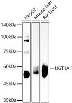 UGT1A1 Recombinant Rabbit Monoclonal Antibody (8U9P3)