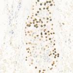 HELLS Antibody in Immunohistochemistry (Paraffin) (IHC (P))