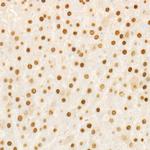 HELLS Antibody in Immunohistochemistry (Paraffin) (IHC (P))