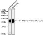 Folate Receptor alpha Recombinant Rabbit Monoclonal Antibody (3J6W3)