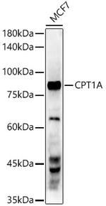 CPT1A Recombinant Rabbit Monoclonal Antibody (3M6E9)