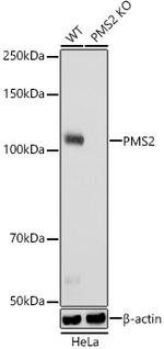 PMS2 Recombinant Rabbit Monoclonal Antibody (4T9W4)